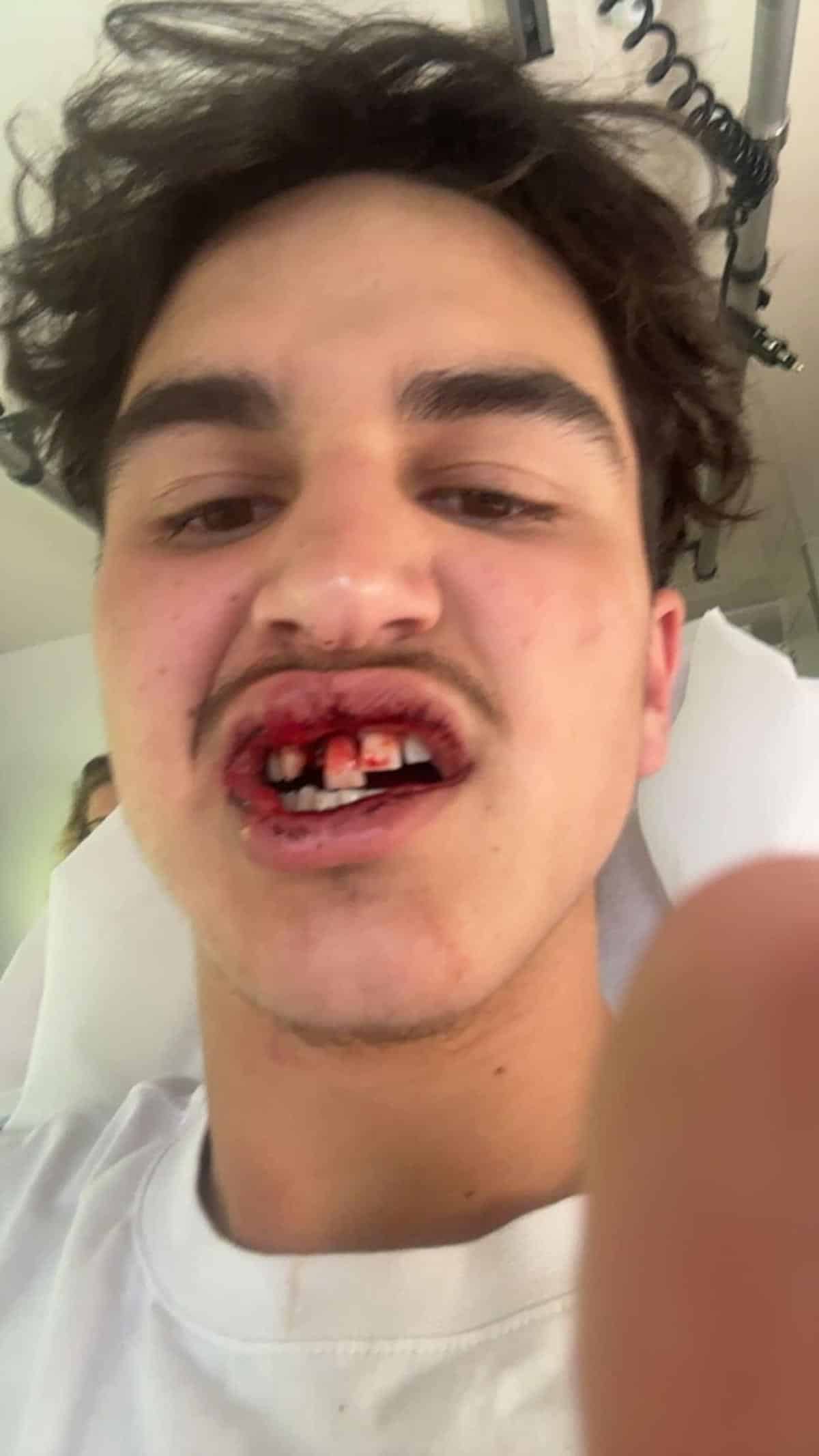 Le jeune homme de 19 ans compte déposer plainte.